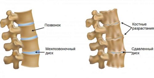 2-я Ступень Академии Массажа Микулина А.Л. (Проект) - Воронеж